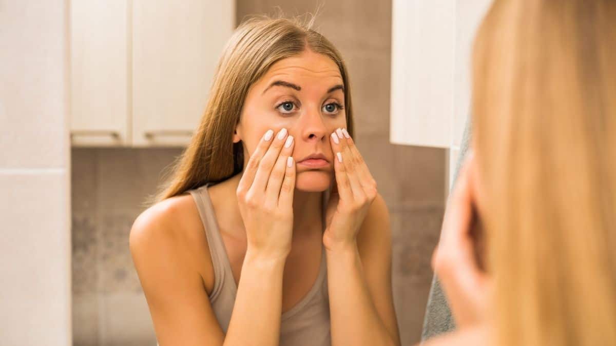 under eye bags